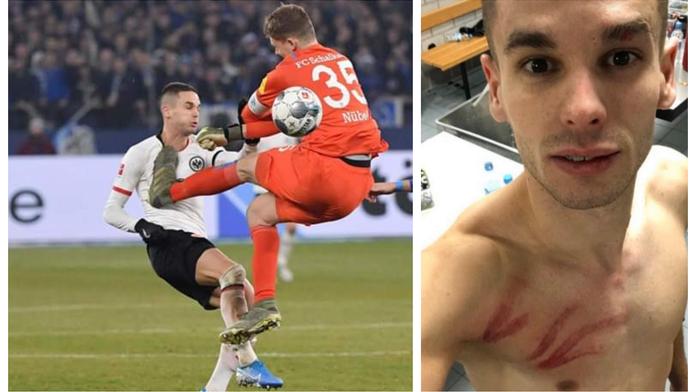 Faul roku! Brankář v bundeslize podrážkou ocejchoval útočníka