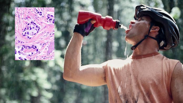 Pozor na polykarbonátové láhve! Může v nich být smrtící bisfenol, který vyvolává RAKOVINU