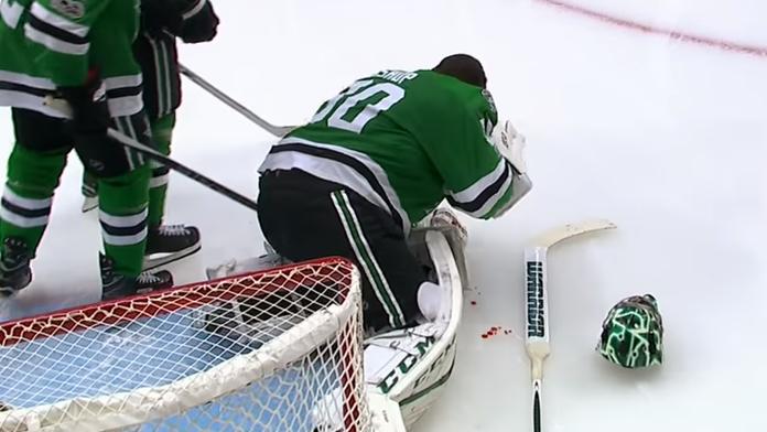 Šílená zranění z posledních hodin v NHL: FOTO jen pro silné povahy!