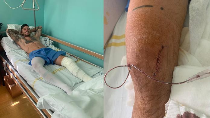 Smolař Kadlec je po další operaci. Tentokrát transplantaci chrupavky!