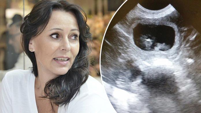 Heidi čeká přírůstek do rodiny! Pochlubila se fotkou z ultrazvuku