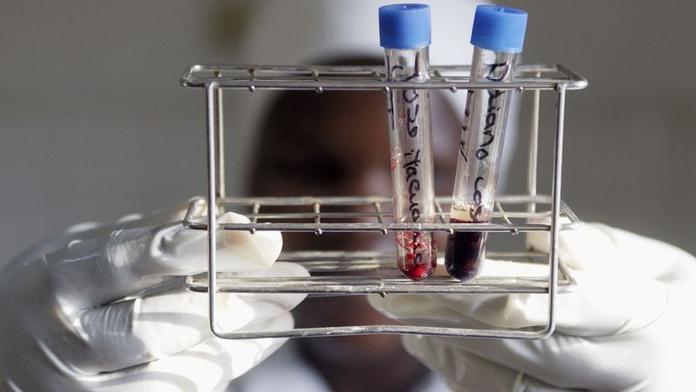 Studie velmi znepokojila vědce. V lidské krvi našli mikroplasty