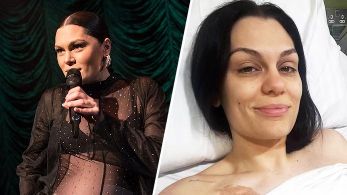 Jessie J podstoupila operaci
