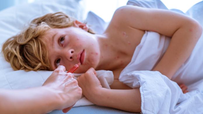 Vypukla epidemie spalniček, zabíjí desítky lidí v Evropě! PŘÍZNAKY
