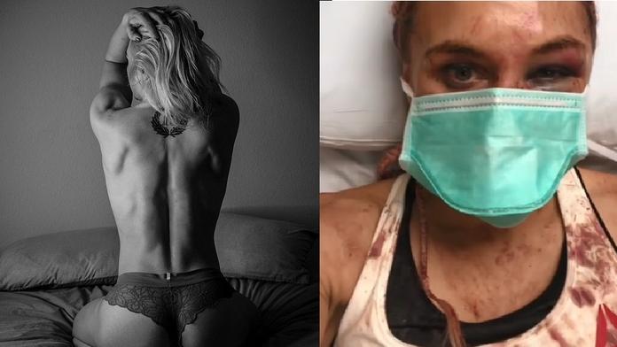 Drsná proměna: Kráska z UFC byla po zápase k nepoznání!