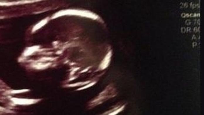 Miminko dalo mámě vzkaz už na ultrazvuku! FOTO UVNITŘ