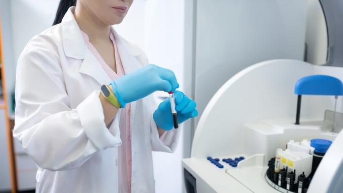 Nová naděje v léčbě rakoviny! Krevní test odhalí až 50 typů nemoci