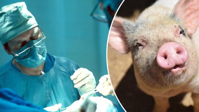 Lékaři hlásí průlom v transplantacích, žena dostala ledvinu z prasete
