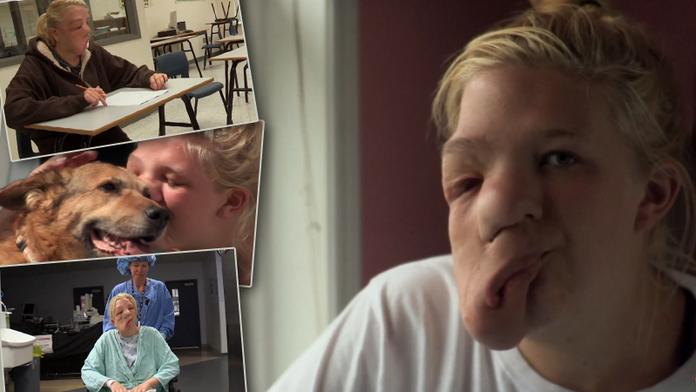 Dívka (17) promluvila o šikaně! Kvůli své tváři zažívá peklo