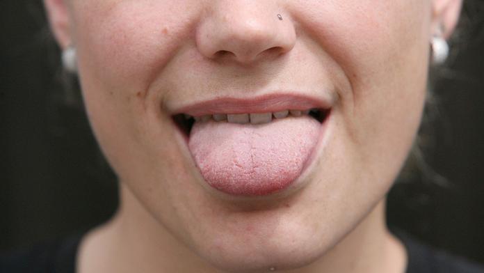 Co všechno můžete vyčíst z jazyka? Důležitá je barva a tvar