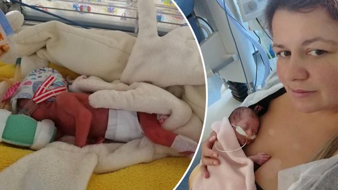 Jituška po narození vážila 650 gramů. Už je doma u rodičů!