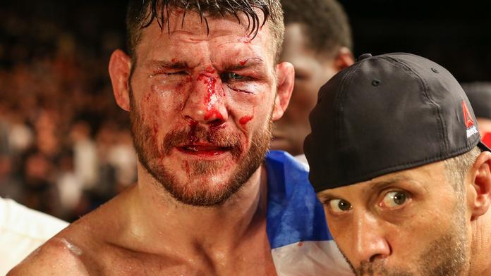 Šampion Bisping terčem vtípku: Vyzyvatel vybírá na jeho léčebné výlohy
