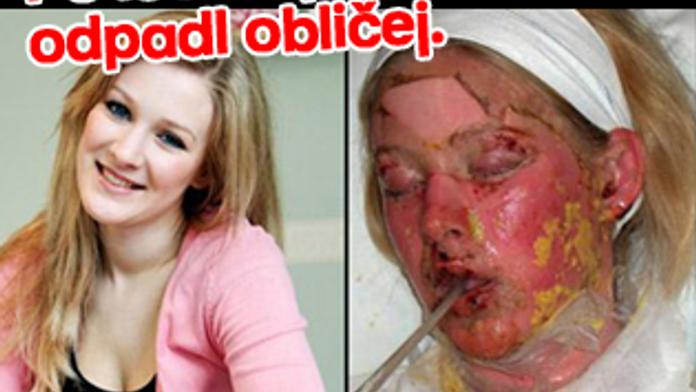 Po lécích jí zčernal a odpadl obličej. Už ho má zpět