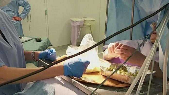 60letá žena z Itálie během skoro tříhodinové operace mozku plnila olivy