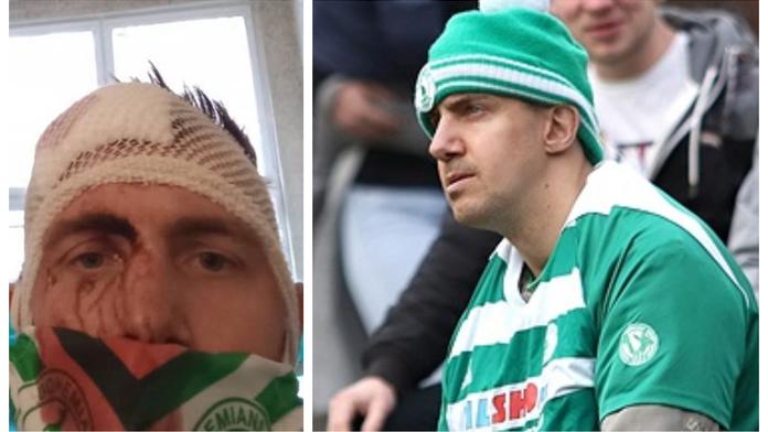 Skalní fanoušek Bohemky skončil v nemocnici! Takhle to klub vysvětlil&nbsp;&nbsp;