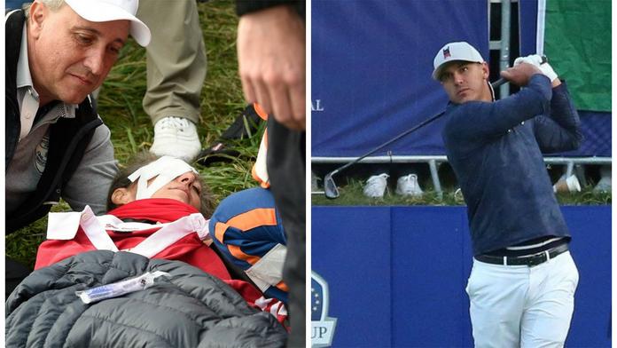 Rána přímo nad oko! Ryder Cup začal nepříjemným zraněním