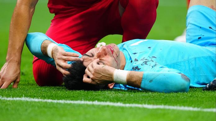 Proč Írán mohl střídat šestkrát? Ve hře bylo nové pravidlo