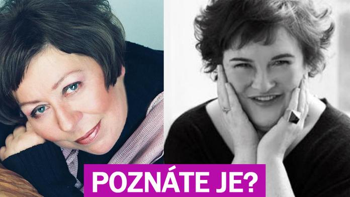 Celebrity, POZOR! Lidé vás chtějí vidět bez retuší