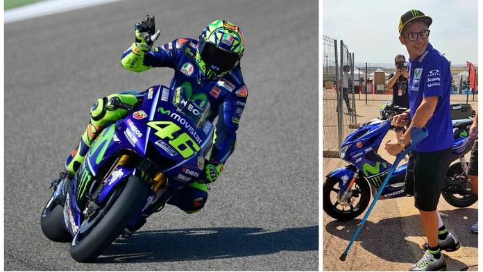Šílené! Rossi přišel k motorce o berlích, pak si vyjel první řadu