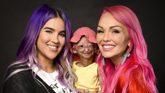 Už v mládí vypadala jako stařenka. Dívka, která stárla osmkrát rychleji, zemřela