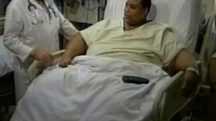 Morbidně obézní Američan vážil půl tuny