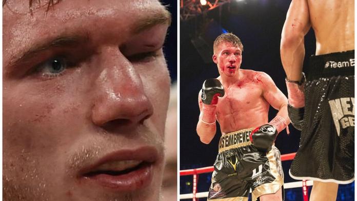 Hrozivý pohled: Boxer skončil s krvácením do mozku v kómatu!