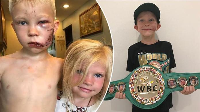 Šestiletý hrdina se stal nejmladším držitelem boxerského pásu WBC