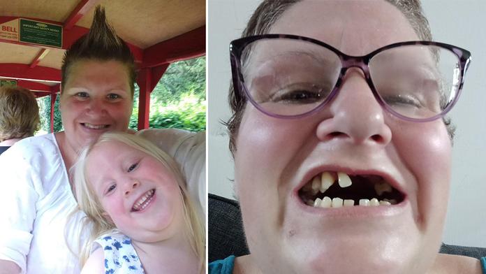 Britka si sama vytrhla 11 zubů. "Neměla jsem na zubaře a teď trpím," pláče