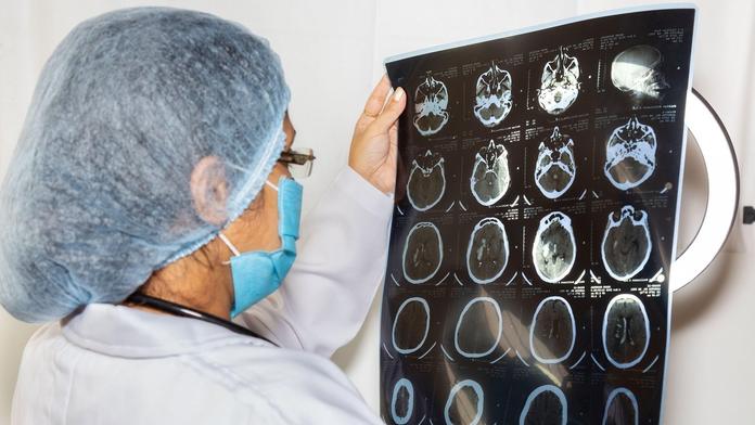 Lidé často podceňují příznaky zákeřné nemoci. Lékaři před ní důrazně varují