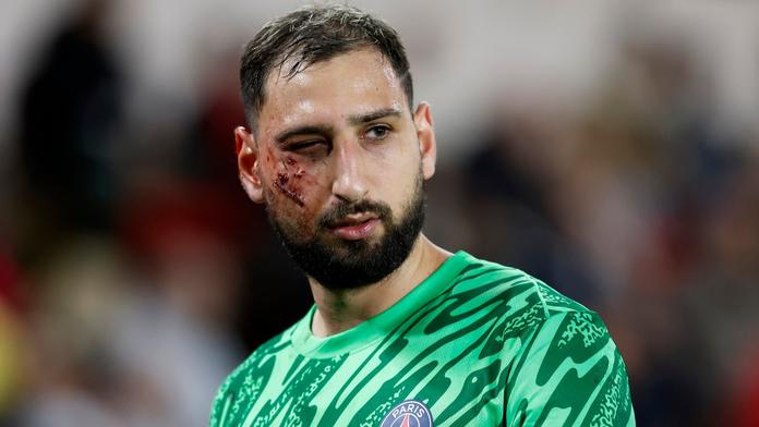 Donnarumma PSG fotbal zranění