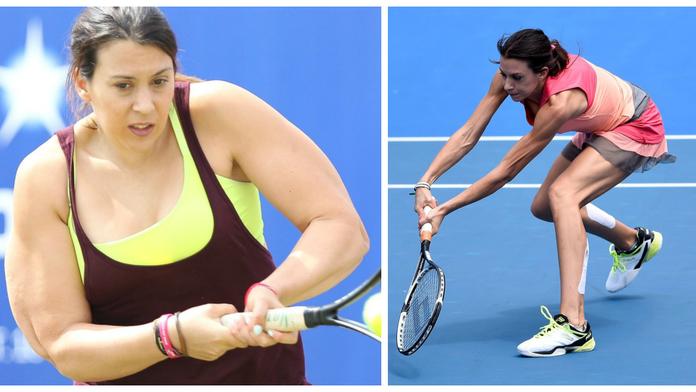 Co se jí stalo?! Macatá šampionka z Wimbledonu je kost a kůže