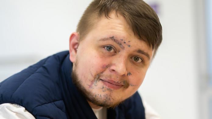 Hrdina Roman potřebuje novou ruku