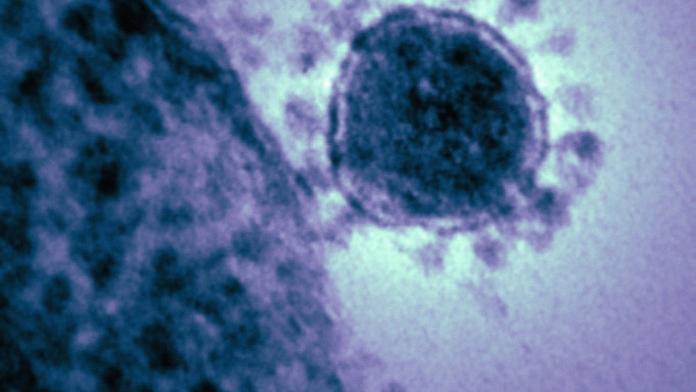 STRACH z viru MERS: Vzorky jsou v Praze, výsledky budou večer