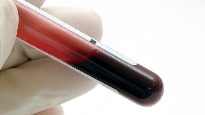 Neobjevená nemoc může zabít 80 milionů lidí, varují experti