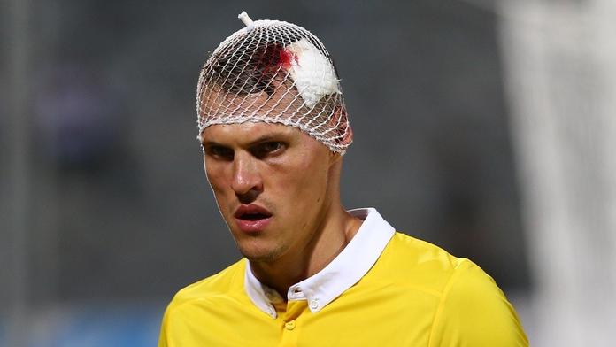 Fanouškům zatrnulo: Slovenský kapitán Škrtel ležel v krvi! VIDEO