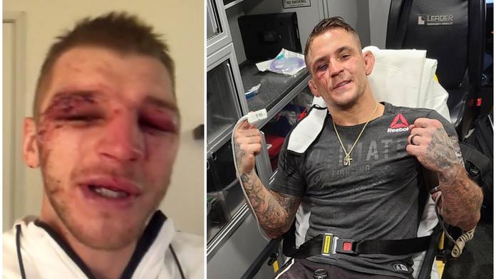 Poirier s Hookerem stanovili nový UFC rekord! Takhle dopadli po zápase