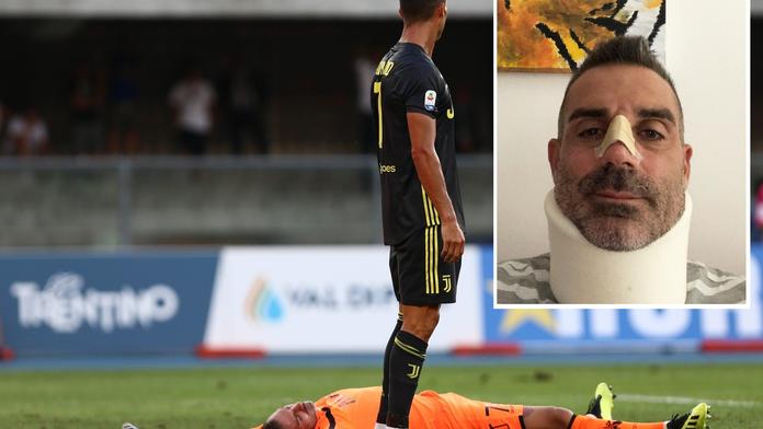 První zářez CR7 v Serii A: Gólman v bezvědomí se zlomeným nosem!