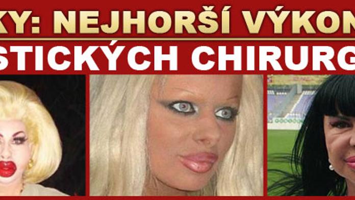 FOTO: Nejhorší výkony plastických chirurgů!