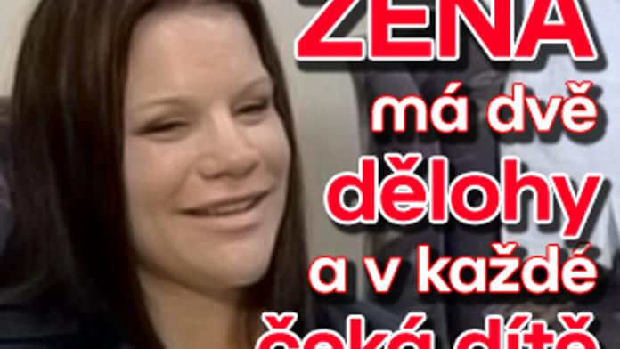 Žena má dvě dělohy a v každé čeká dítě
