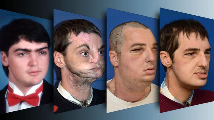 Richard (37) si ustřelil obličej, lékaři s ním dokázali zázraky