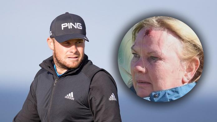 Další krvavé zranění fanynky na golfu: Po míčku díra v čele! FOTO
