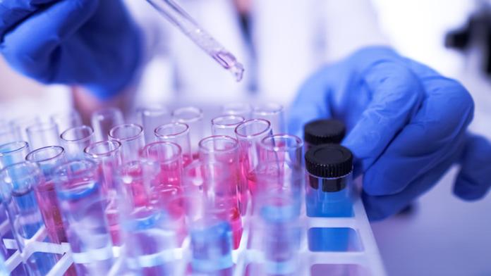 Vědci vyvinuli průlomový krevní test! Rozpozná vážný průběh koronaviru