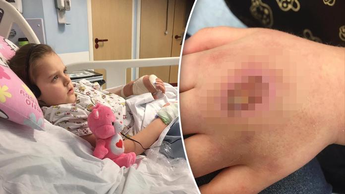 Po koupání skončila s dírou v ruce! Málem zemřela, bojí se domů