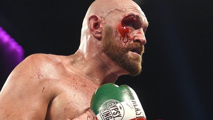 Fury krvácel, přesto zápas vyhrál. Pak musel do nemocnice na šití