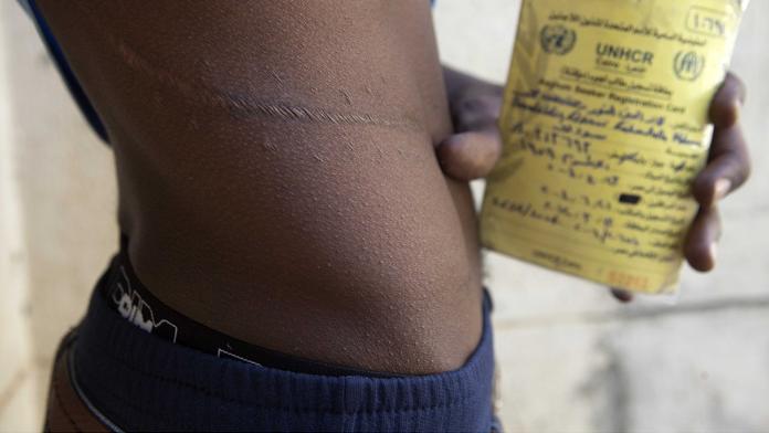 Do Evropy za ledvinu! Migranti za cestu přes moře platí orgány