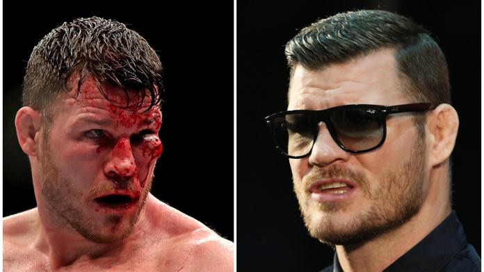 UFC šampion zápasil pět let skoro slepý! Nakonec raději ukončil kariéru