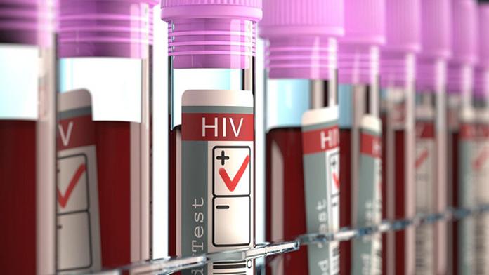 Vědci hlásí průlom v léčbě HIV. Máme "vypínač" viru, tvrdí!