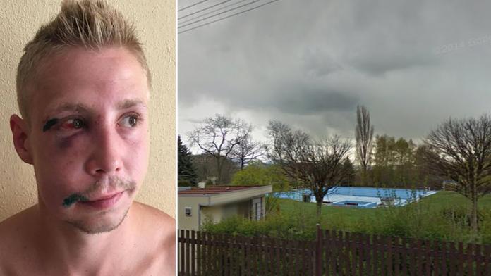 Je to jinak, tvrdí svědkyně o bitce v Dubí: Není to hrdina, praštil ženu