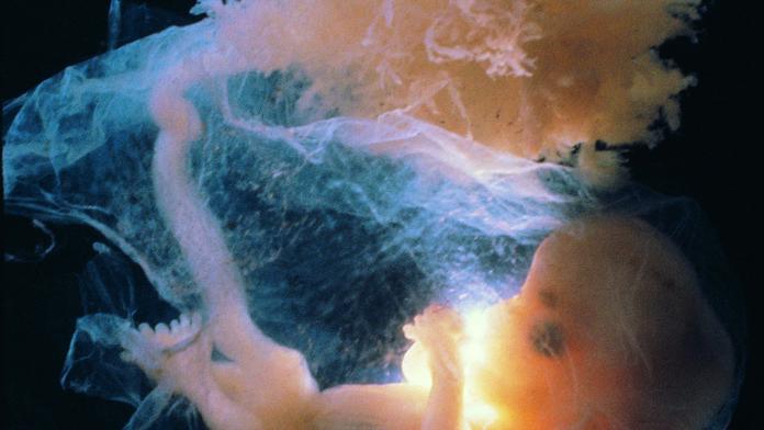 Děs na Slovensku! V čističce plavalo lidské embryo!
