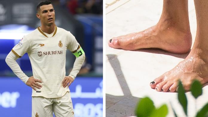 Proč si Ronaldo lakuje nehty na černo? Důvod je praktický